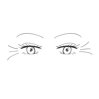 wrinkle of eyelid-illustration