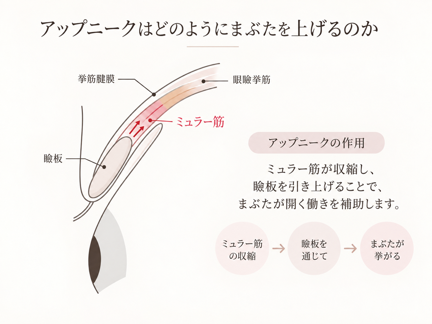ミュラー筋と作用機序の説明図